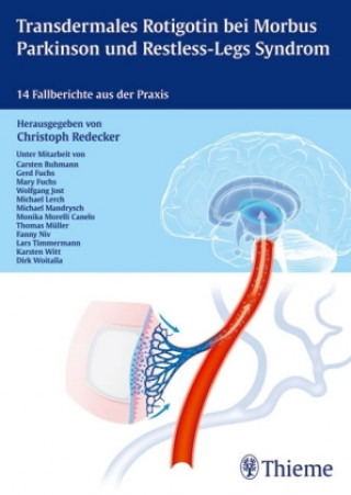 Carte Transdermales Rotigotin bei Morbus Parkinson und Restless-Legs Syndrom Christoph Redecker
