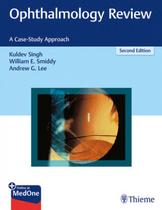 Carte Ophthalmology Review Kern Singh