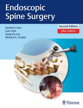 Carte Endoscopic Spine Surgery Daniel H. Kim
