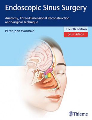 Książka Endoscopic Sinus Surgery Peter J. Wormald