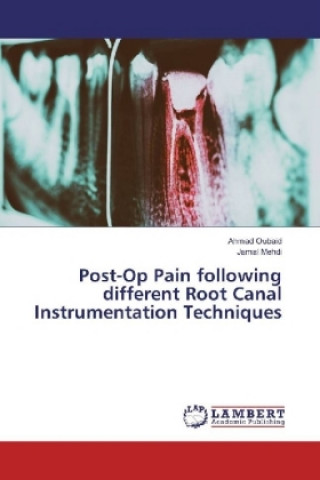 Kniha Post-Op Pain following different Root Canal Instrumentation Techniques Ahmad Oubaid