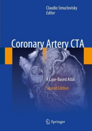 Knjiga Coronary Artery CTA Claudio Smuclovisky