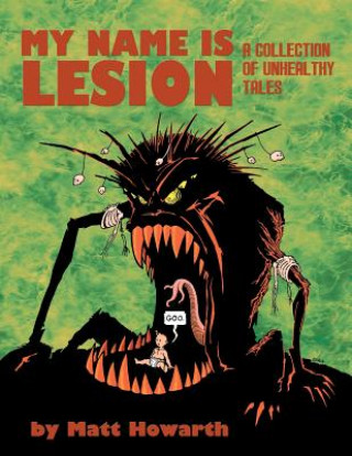 Buch My Name Is Lesion: A Collection of Unhealthy Tales Matt Howarth