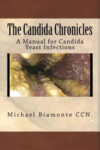 Knjiga The Candida Chronicles: A Mannual for Candida/Yeast Infections Michael C Biamonte Ccn