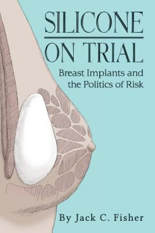 Kniha Silicone On Trial: Breast Implants and the Politics of Risk Jack Fisher