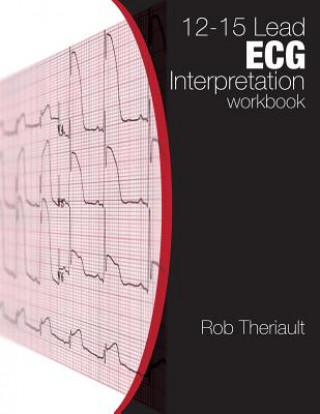 Carte 12-15 Lead ECG Interpretation: Workbook Rob Theriault