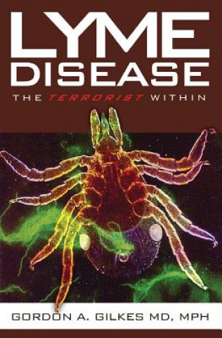 Buch Lyme Disease: The Terrorist Within Gordon Gilkes