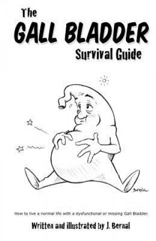 Kniha The Gall Bladder Survival Guide: How to live a normal life with a missing or dysfunctional gall bladder. Jeremy Bernal