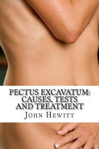 Książka Pectus Excavatum: Causes, Tests and Treatment John Hewitt Ma