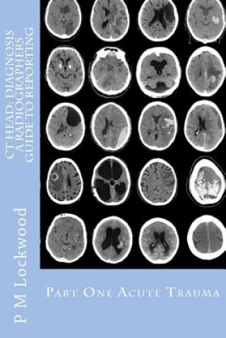 Könyv CT Head: DIAGNOSIS A Radiographers Guide To Reporting Part 1 Acute Trauma: Part One Acute Trauma P M Lockwood