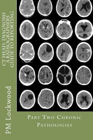 Kniha CT Head: DIAGNOSIS A Radiographers Guide To Reporting Part 2 Chronic Pathologies: Part 2 Chronic Pathologies P M Lockwood