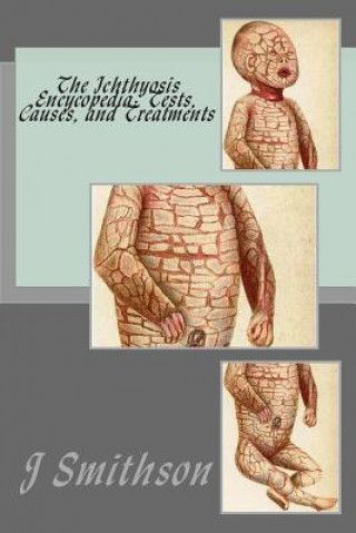 Kniha The Ichthyosis Encycopedia: Tests, Causes, and Treatments J P Smithson Ma