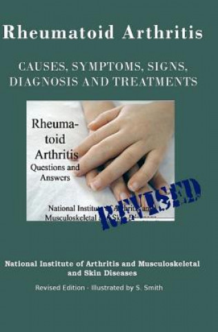 Carte Rheumatoid Arthritis: Causes, Symptoms, Signs, Diagnosis and Treatments - Revised Edition - Illustrated by S. Smith National Institute of Mental Health