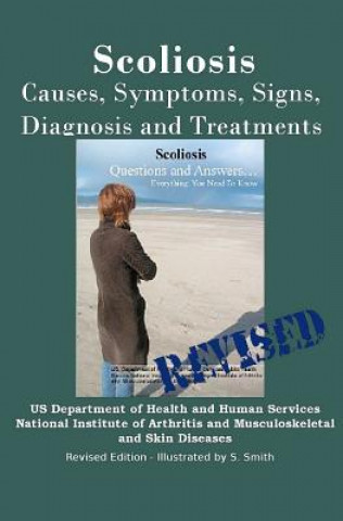 Buch Scoliosis: Revised Edition: Causes, Symptoms, Signs, Diagnosis and Treatments Institutes of Health National Institute