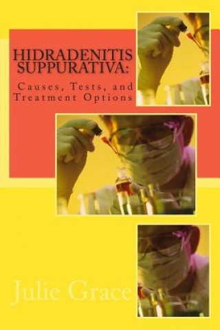 Libro Hidradenitis Suppurativa: Causes, Tests, and Treatment Options Julie Grace Ma