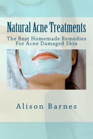 Kniha Natural Acne Treatments: The Best Homemade Remedies For Acne Damaged Skin Alison Barnes