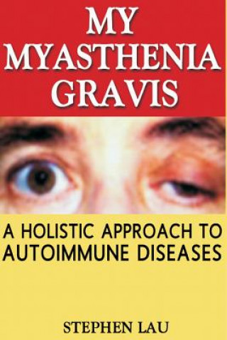 Könyv My Myasthenia Gravis: A Holistic Approach to Autoimmune Diseases MR Stephen Lau