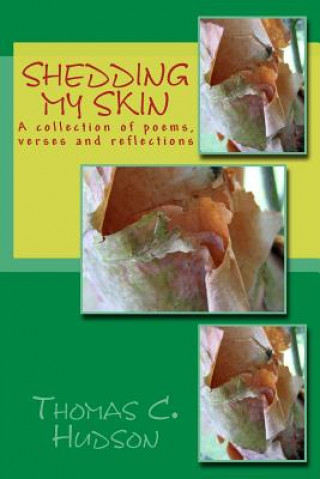 Βιβλίο Shedding My Skin MR Thomas C Hudson