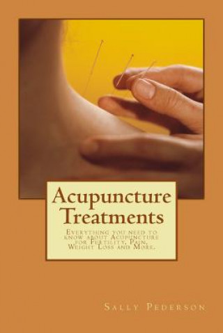 Kniha Acupuncture Treatments: Everything You Need to Know about Acupuncture for Fertility, Pain, Weight Loss and More. Sally Pederson