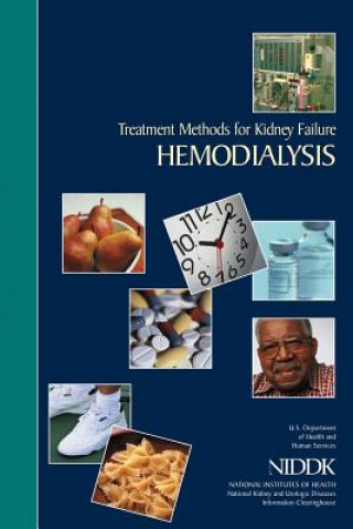 Carte Treatment Methods for Kidney Failure: Hemodialysis U S Department of Healt Human Services