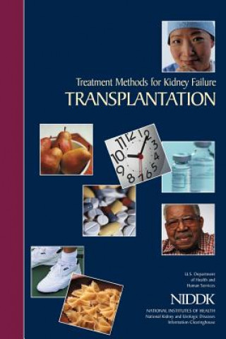 Kniha Treatment Methods for Kidney Failure: Transplantation U S Department of Healt Human Services
