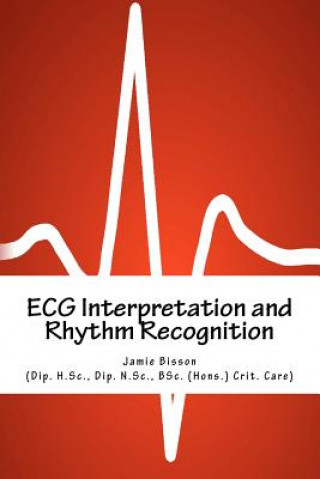 Book ECG Interpretation and Rhythm Recognition MR Jamie Bisson