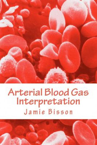Könyv Arterial Blood Gas Interpretation MR Jamie Bisson