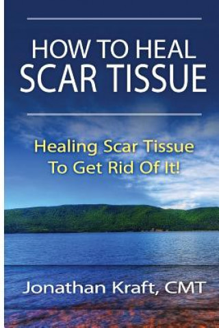 Könyv How to Heal Scar Tissue: How to Heal Your Own Scar Tissue And Get Rid Of It! Jonathan a Kraft
