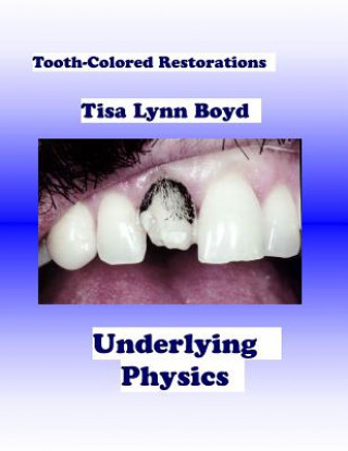 Knjiga Tooth-Colored Restorations: Underlying Physics Tisa Lynn Boyd