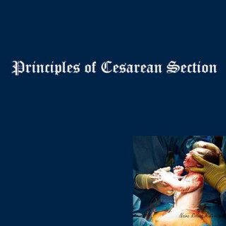 Książka Principles of Cesarean Section Dr Naira R Matevosyan