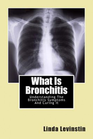 Knjiga What Is Bronchitis: Understanding The Bronchitis Symptoms And Curing It Dr Linda Levinstin