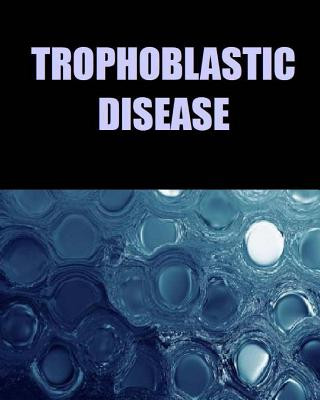 Könyv Trophoblastic Disease Dr Naira R Matevosyan