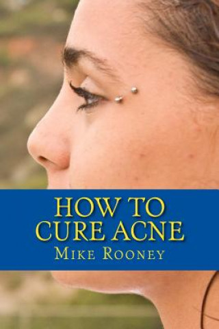 Carte How To Cure Acne: What Is Acne And The Best Treatments For Acne Mike Rooney