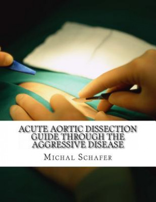 Knjiga Acute Aortic Dissection: Guide Through the Aggressive Disease Michal Schafer
