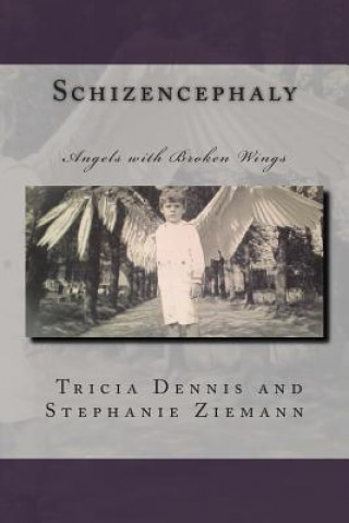 Knjiga Schizencephaly Tricia Dennis