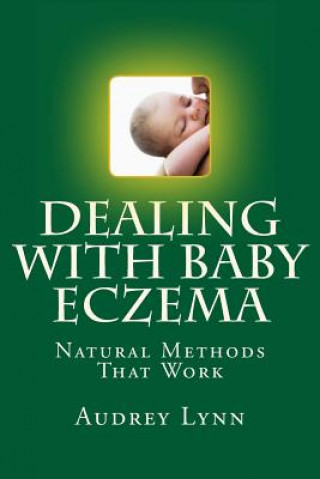 Kniha Dealing With Baby Eczema: Natural Methods That Work Audrey Lynn