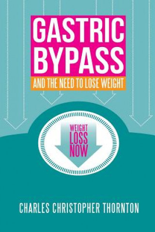 Könyv Gastric Bypass and the Need to Lose Weight Charles Christopher Thornton