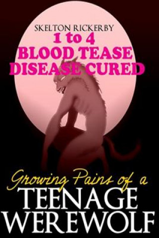 Carte Growing Pains of a Teenage Werewolf Books 1 to 4: Blood/Tease/Disease/Cured Skelton Rockerby