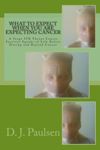 Книга What to Expect When You Are Expecting Cancer: A Stage IVB Throat Cancer Survivor Speaks of Life Before During and Beyond Cancer D J Paulsen