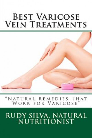 Kniha Best Varicose Vein Treatments: Natural Remedies That Work for Varicose Rudy Silva Silva