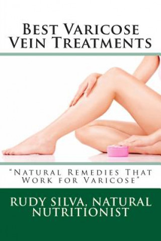 Buch Best Varicose Vein Treatments: Natural Remedies That Work for Varicose Rudy Silva Silva