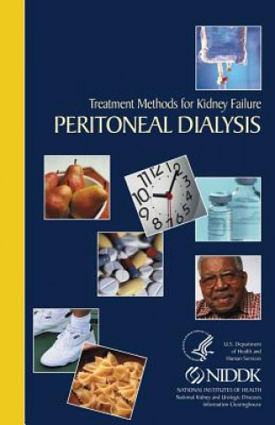 Carte Treatment Methods for Kidney Failure Peritoneal Dialysis National Institute of Diabetes and Diges
