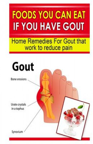 Könyv Foods You Can Eat If You Have Gout: Home Remedies for Gout That Work to Reduce Pain Doc Goodman