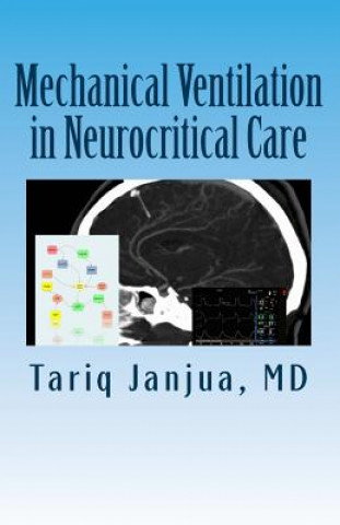 Carte Mechanical Ventilation in Neurocritical Care Tariq Janjua MD