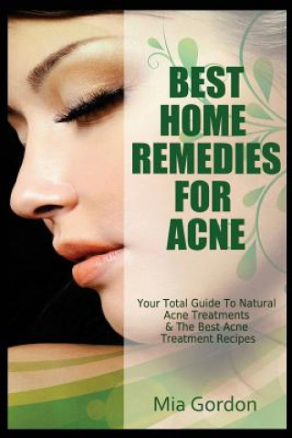 Kniha Best Home Remedies For Acne: Your Total Guide To Natural Acne Treatments & The Best Acne Treatment Recipes Mia Gordon