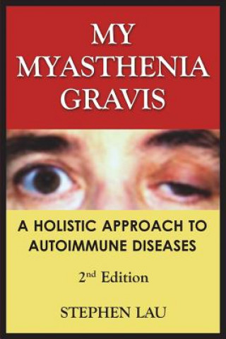 Kniha My Myasthenia Gravis: A Holistic Approach to Autoimmune Diseases Stephen Lau