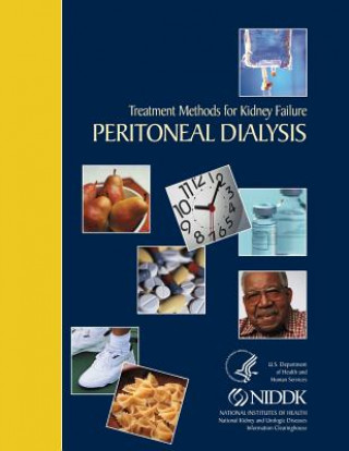 Kniha Treatment Methods for Kidney Failure Peritoneal Dialysis National Institute of Diabetes and Diges