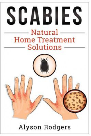 Книга Scabies Natural Home Treatment Solution Alyson Rodgers