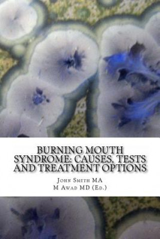 Kniha Burning Mouth Syndrome: Causes, Tests and Treatment Options John Smith Ma