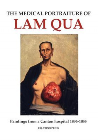Kniha The Medical Portraiture of Lam Qua: Paintings from a Canton hospital 1836-1855 Palatino Press